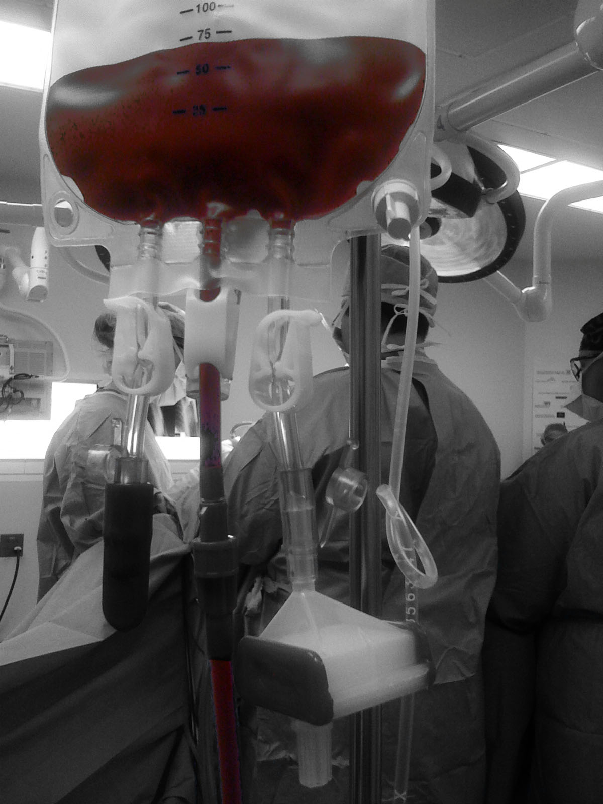 What is Autotransfusion?